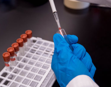 La manipulación genética en humanos. Una mejora de nuestra vida que entraña riesgos