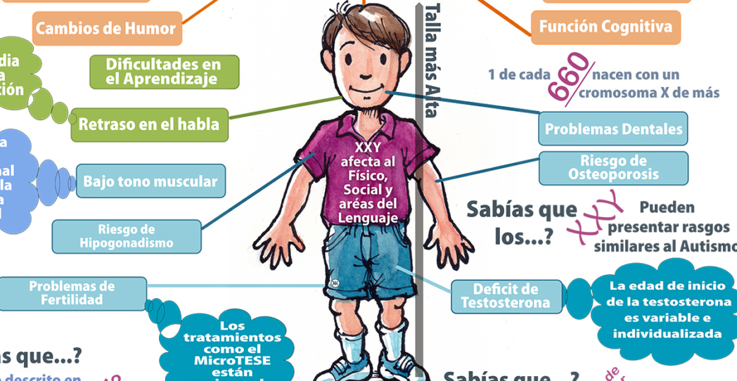 Síndrome de Klinefelter, un gran desconocido